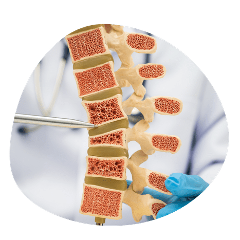 Tuberculosis TB 10 1